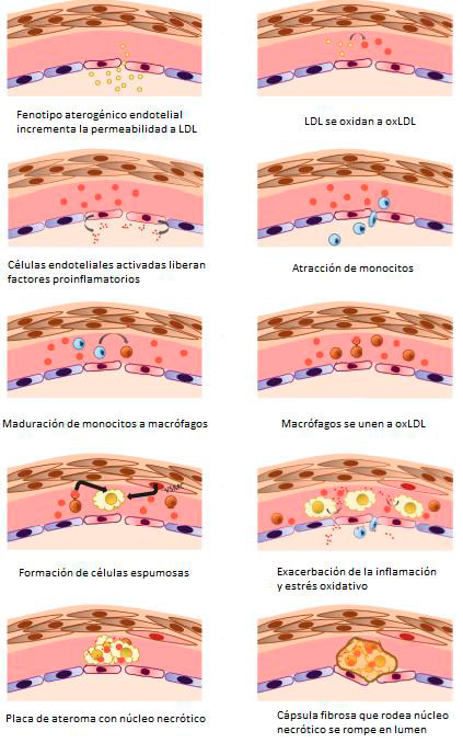 pasos de formación de placa de aterosclerosis