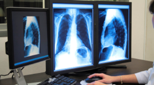Médico cubano hace lectura de radiografías en el departamento de imagenología