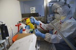 Ébola y VIH utilizan la misma vía para invadir las células inmunitarias
